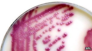 Hospital infections down but new strains emerging