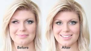 Cosmetic Restoration Eyes
