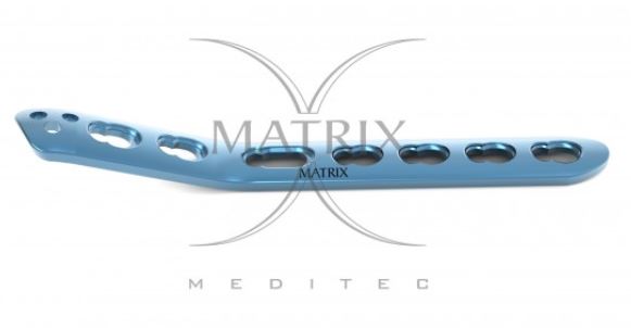 LCP Medial Distal Humerus 3.5mm